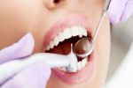 Профессиональное лечение кариеса зубов